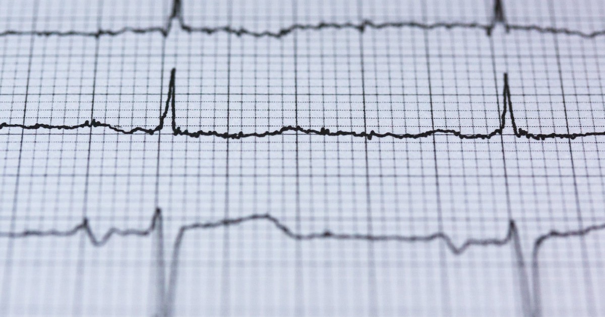 how to become an ekg tech in ny