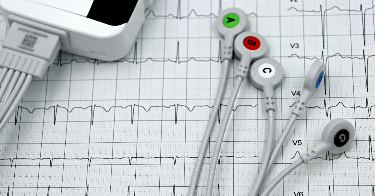 5 Good Reasons to Become an EKG Technician